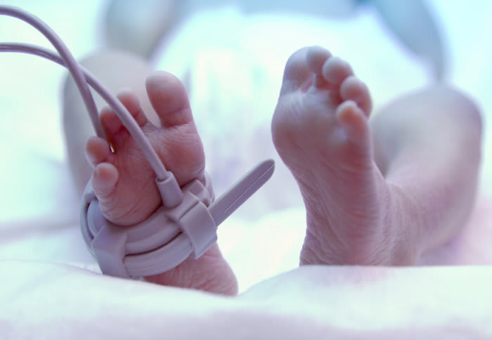 A prematuridade é uma realidade complexa e que não se finaliza com a alta hospitalar